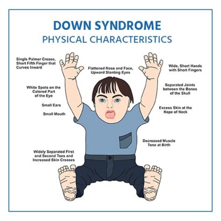 Are certain people more likely to get Down syndrome?
