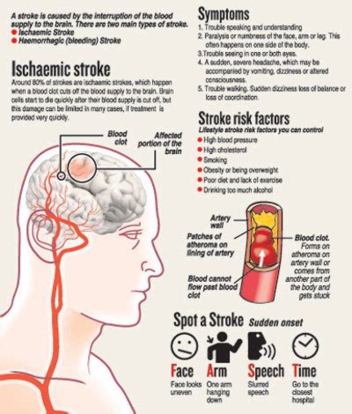 Are strokes painful?