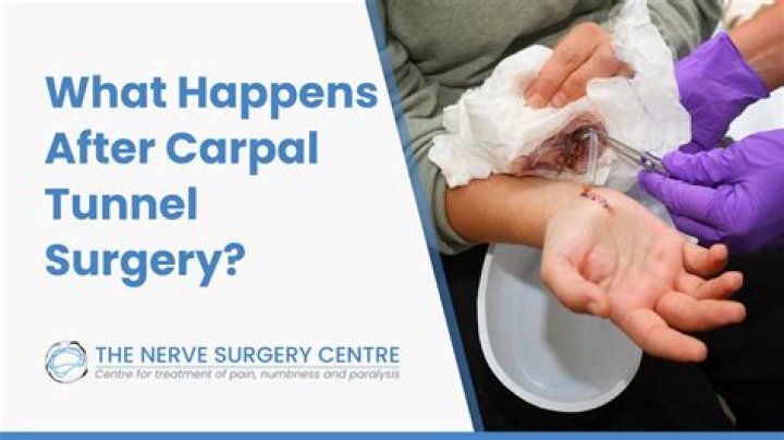 Are you put to sleep for carpal tunnel surgery?