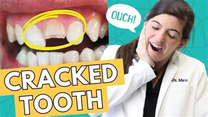 Can a rotten tooth affect your brain?
