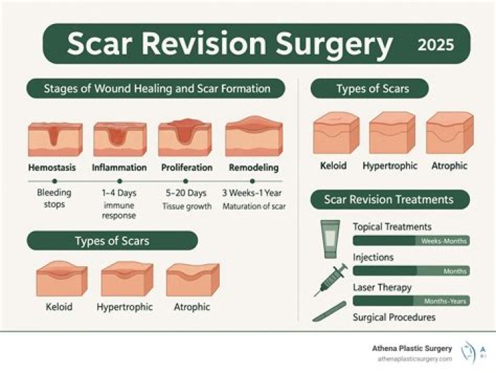 Can a scar reopen after years?