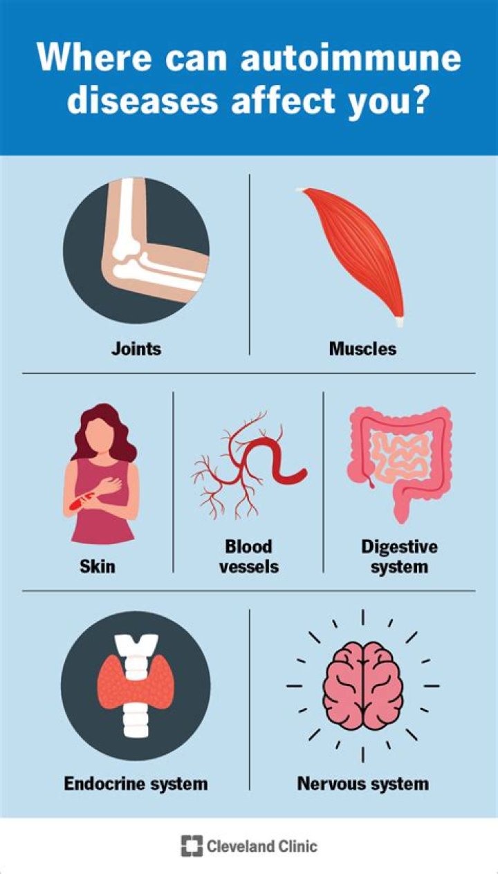 Can autoimmune symptoms come and go?