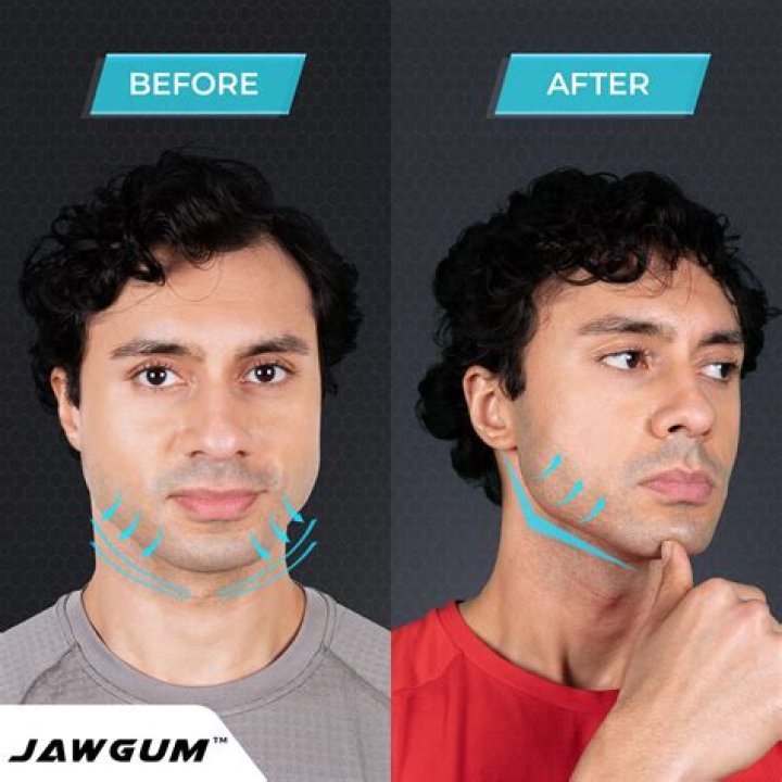 Can chewing gum make you gain weight?