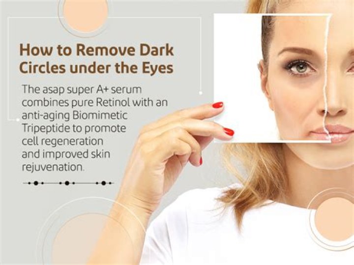 Can potato remove dark circles?