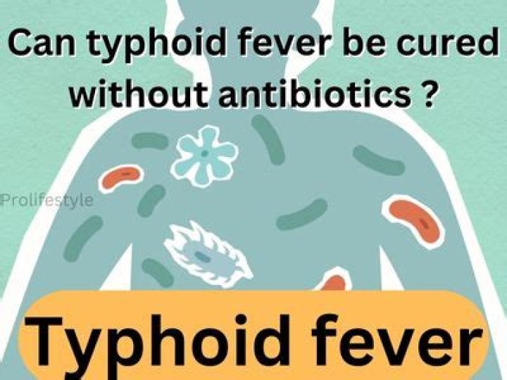 Can typhoid fever be cured without antibiotics?