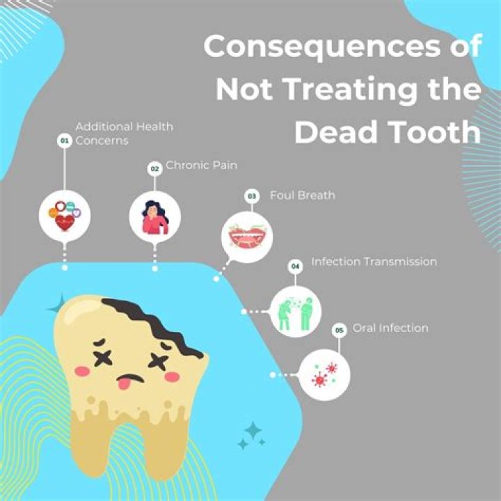 Can untreated tooth cause death?