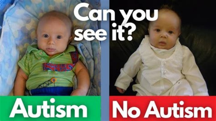 Can you detect autism in newborns?