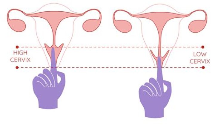 Can you feel your cervix dilating?