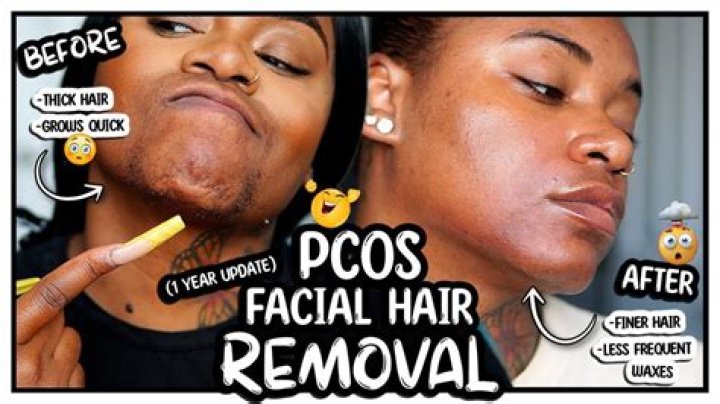 Can you have facial hair at Wendy's?