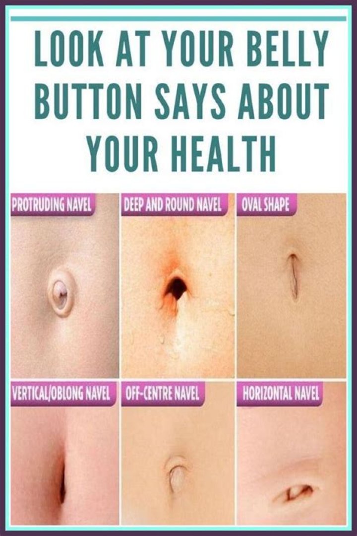 Can your belly button come untied?