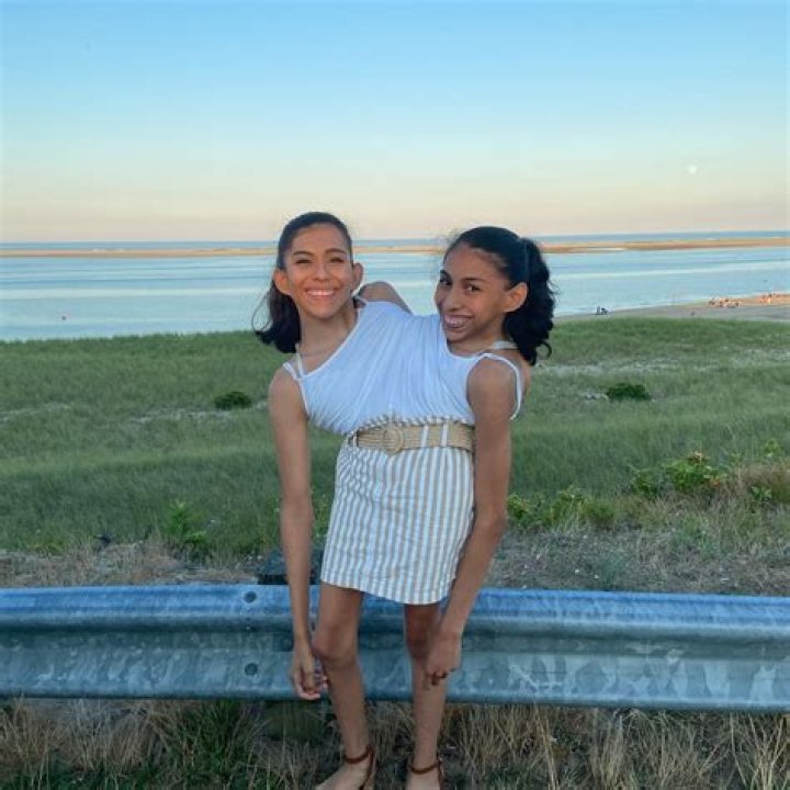 Do conjoined twins pay for one or two tickets?