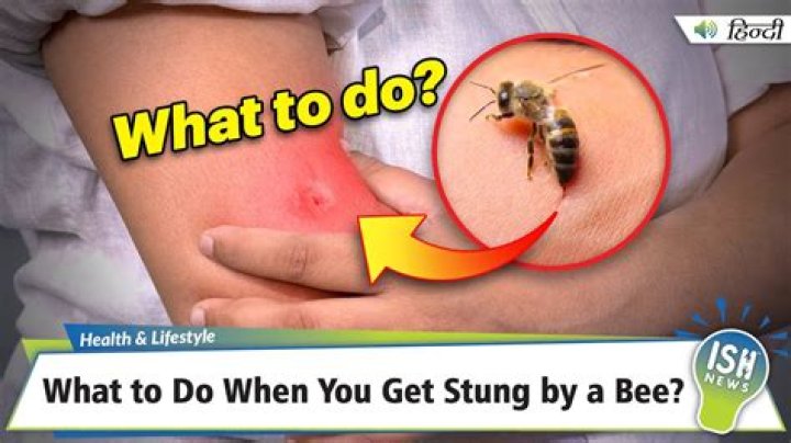 Do you still get stung in a bee suit?