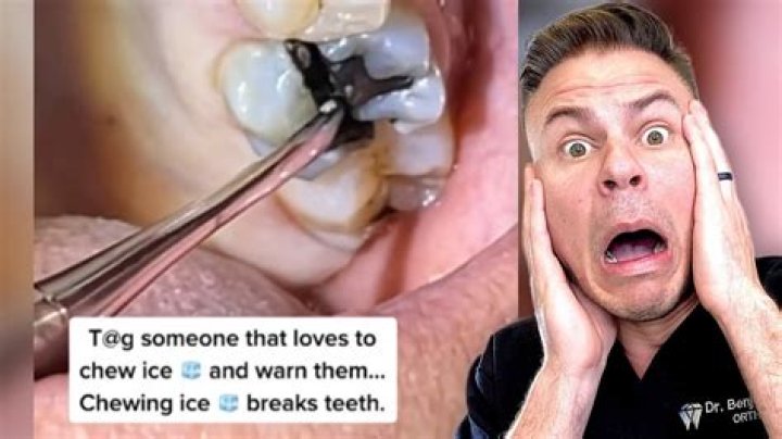 Does crunching ice damage teeth?