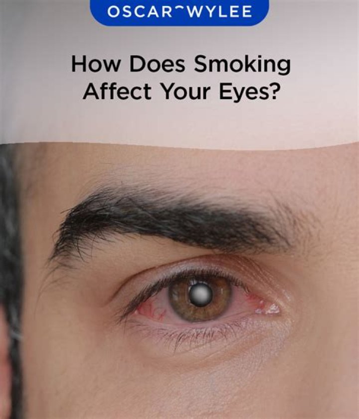 Does crying affect your eyes?