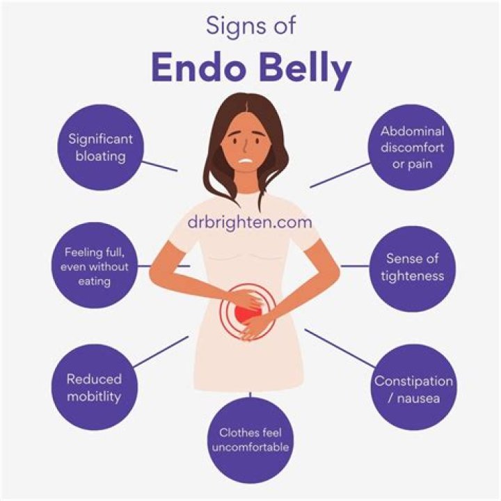 Does Endo belly go away?