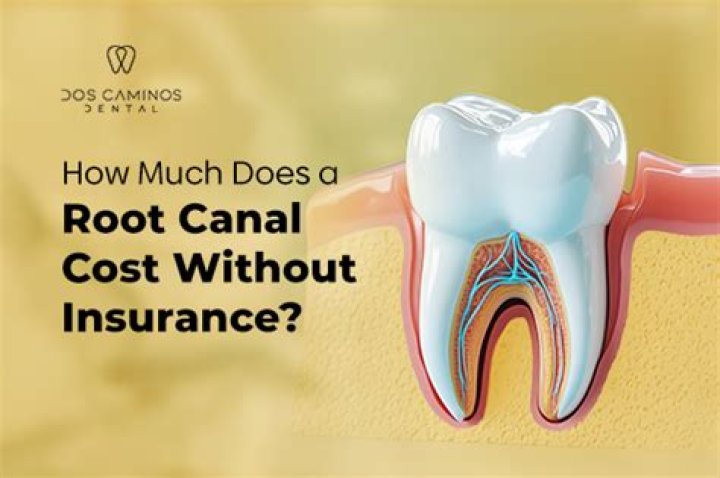 Does insurance cover root canal?