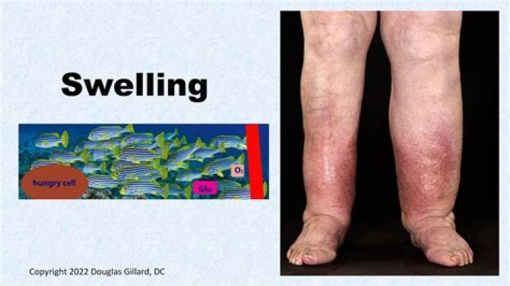 Does obsidian help with swelling?