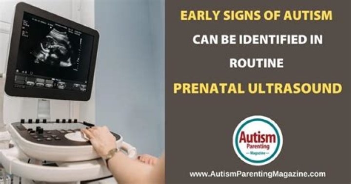 Does prenatal ultrasound cause autism?