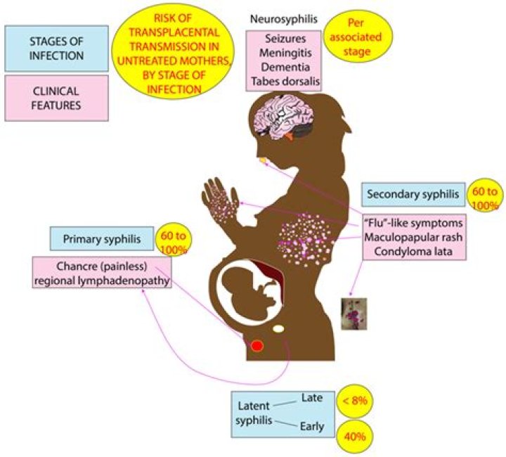 How big is a syphilis sore?