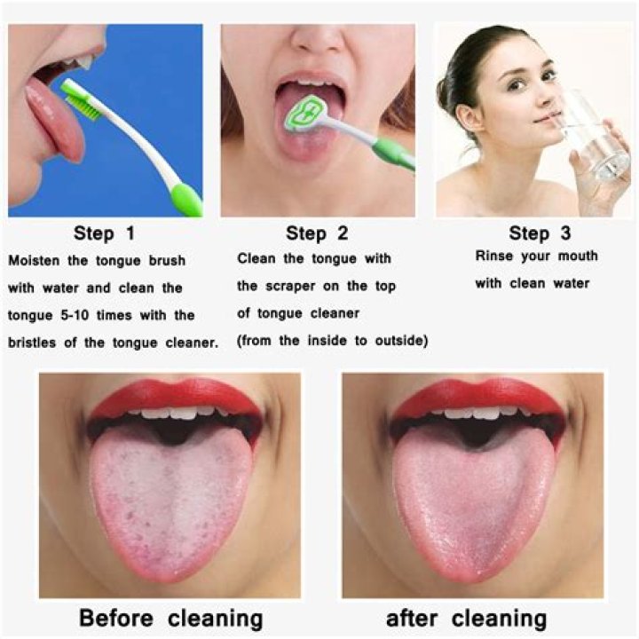 How can I clean my yellow tongue?