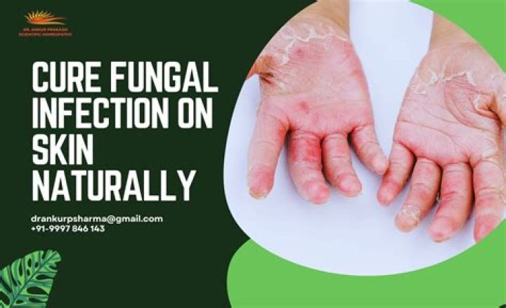 How can I cure an infection naturally?