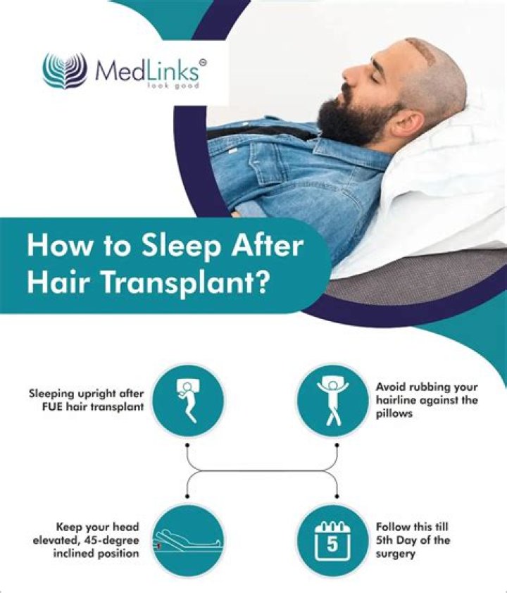 How can I sleep after hair transplant?