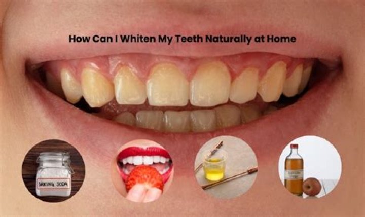 How can I whiten my teeth at home in one day?