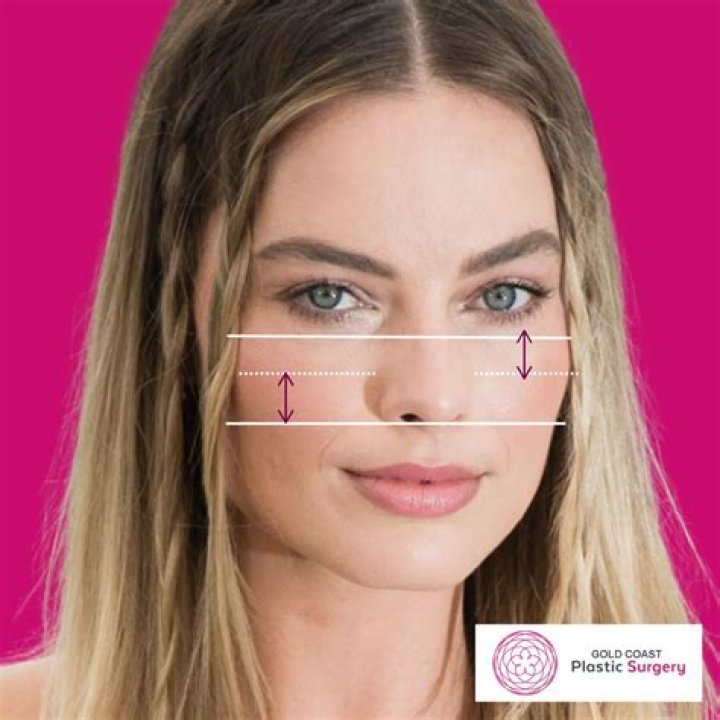 How do I know if I have eye strain?