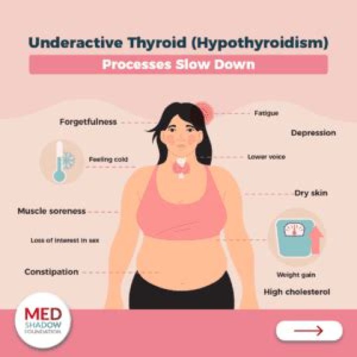How do I know if my hypothyroidism is autoimmune?