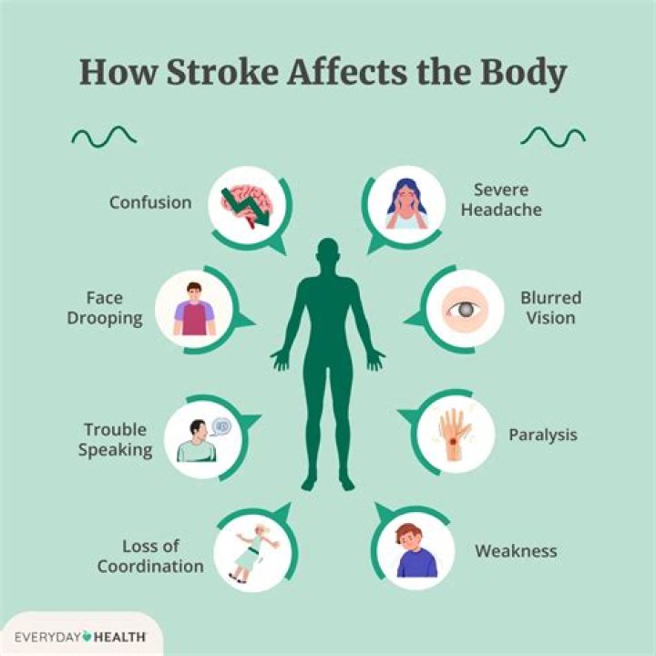 How do you feel before a stroke?