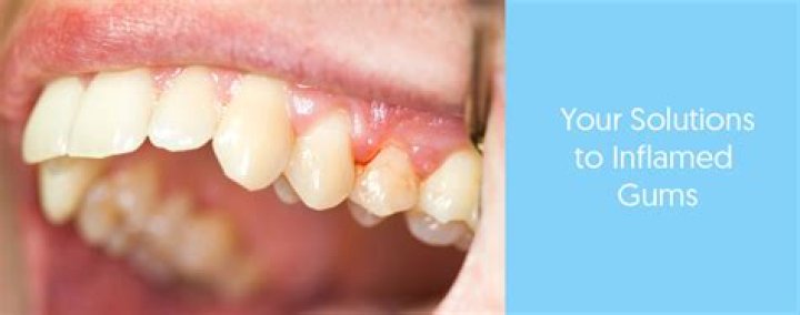 How do you fix inflamed gums?