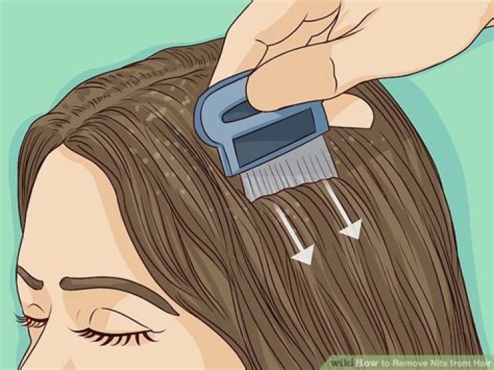 How do you get rid of nits in long thick hair?