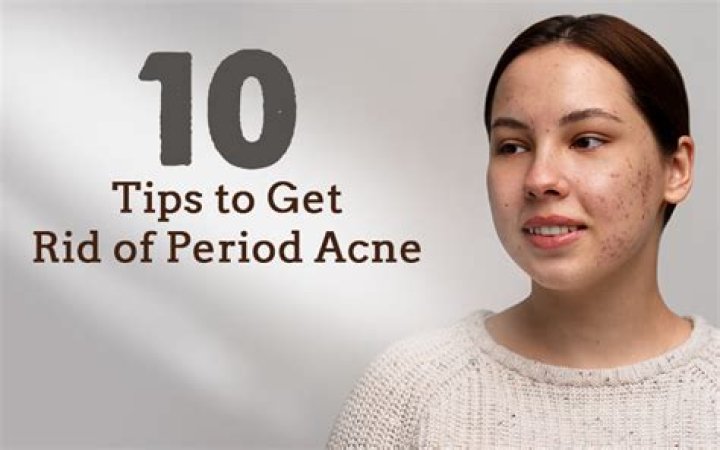 How do you get rid of period pimples?