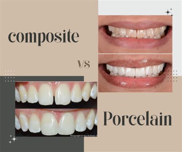 How do you keep porcelain teeth white?