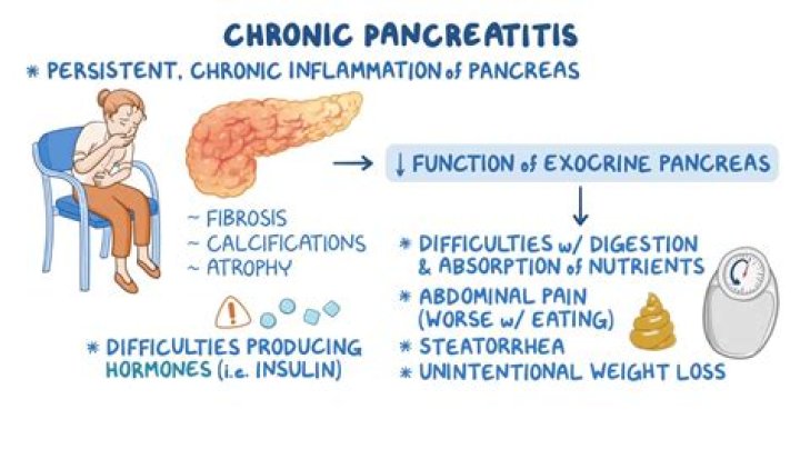 How do you reverse chronic pancreatitis?