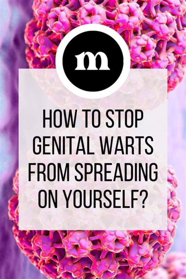 How do you stop warts from spreading?
