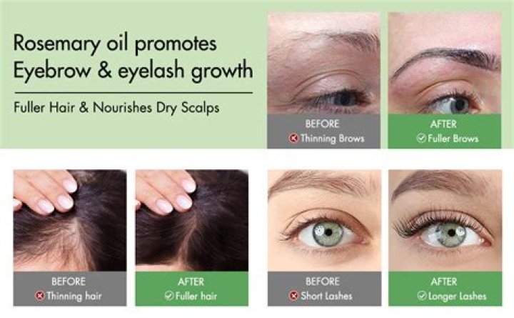 How do you use rosemary for headaches?