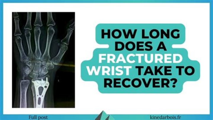How long does it take for a wrist fracture to stop hurting?