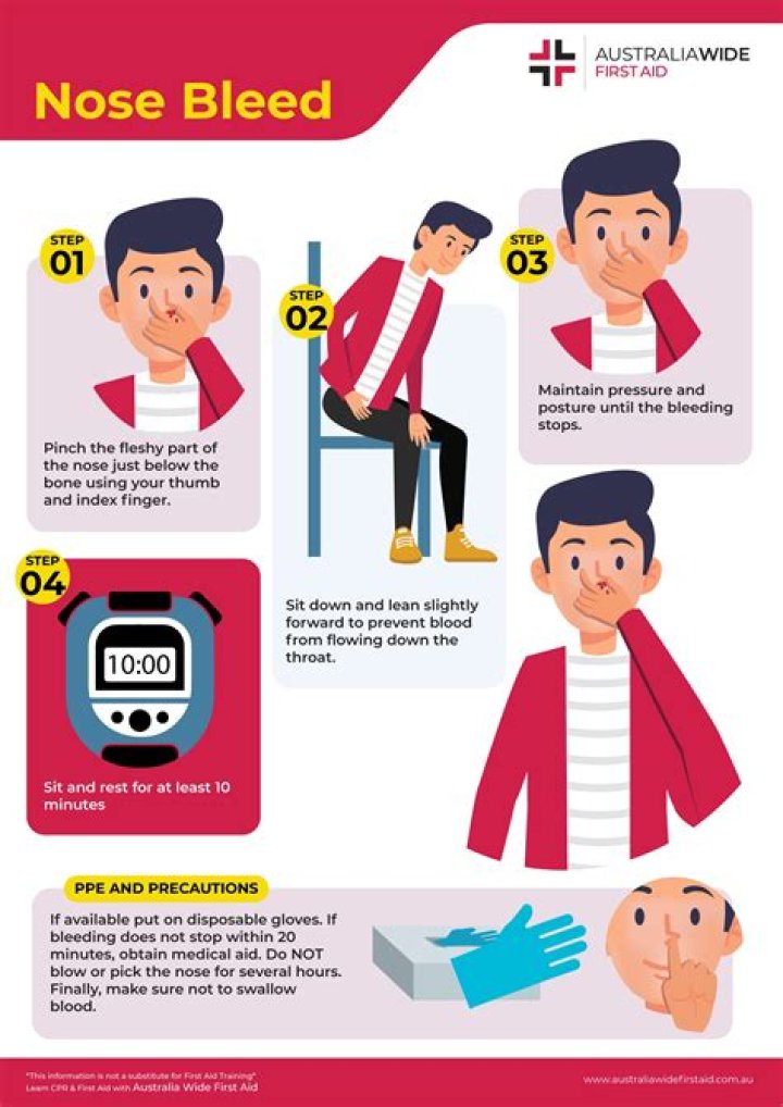 How long is too long for a nosebleed?