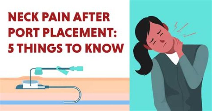 How soon after port placement can it be used?