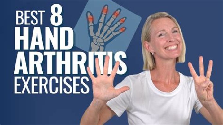 Is a chiropractor good for arthritis?