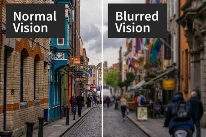 Is blurry vision permanent?