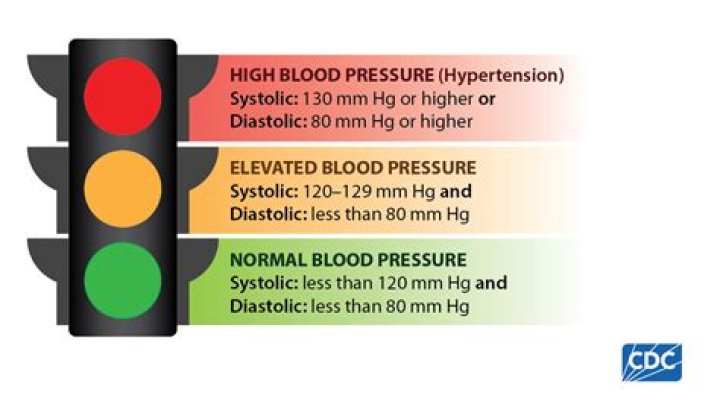 Is diastolic 100 too high?