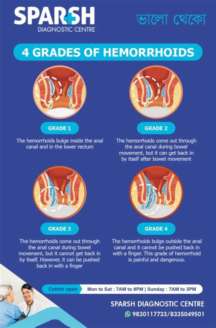 Is rice good for hemorrhoids?