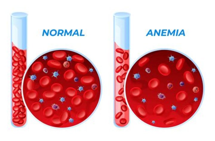 Is tasting blood normal?