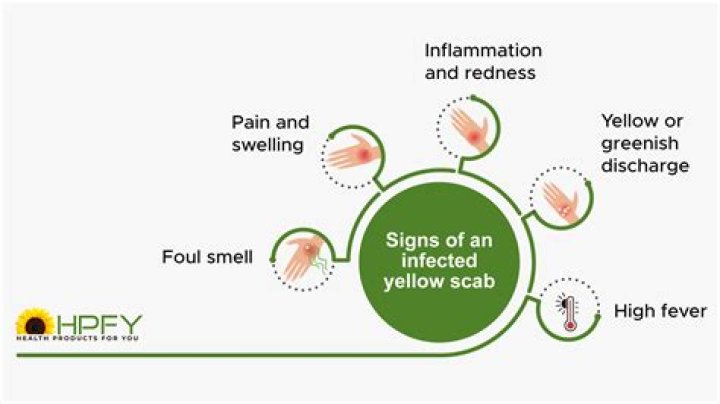 Is yellow on a wound normal?