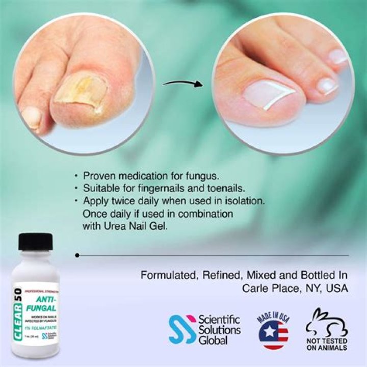 Should I go to a podiatrist for toenail fungus?