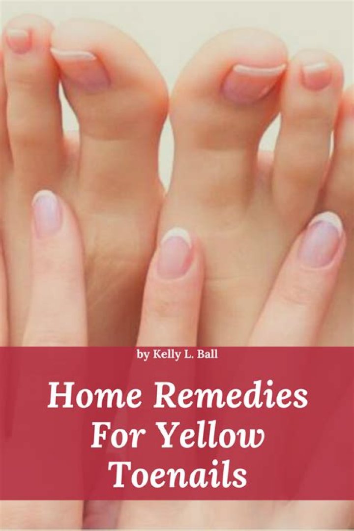 What's good for yellow toenails?