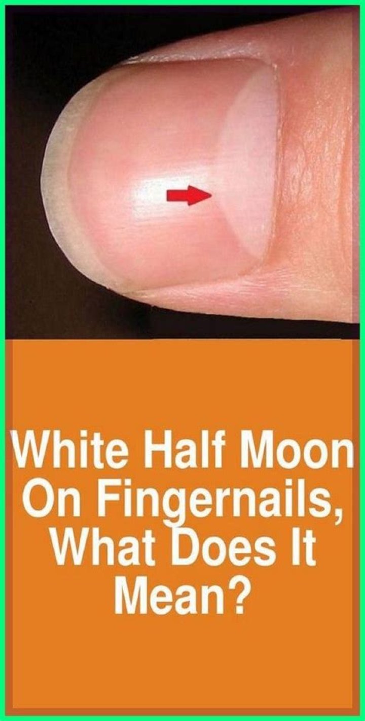 What are moons on fingernails?