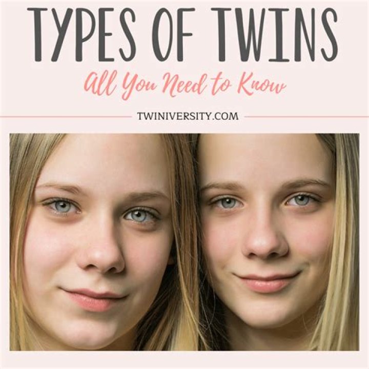 What are the 3 different types of twins?